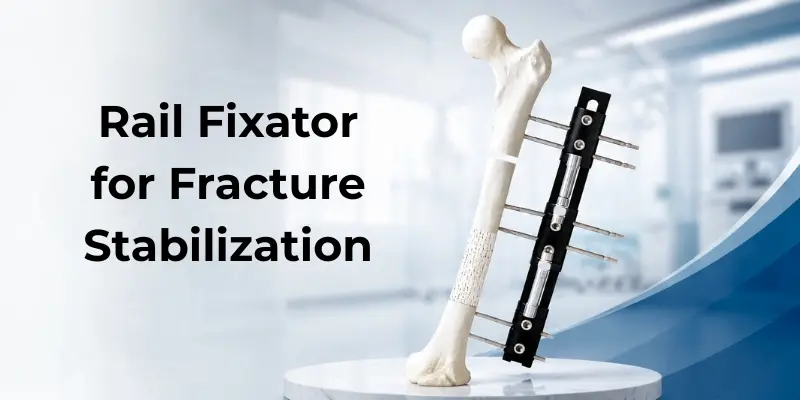 Rail Fixator for Fracture Stabilization