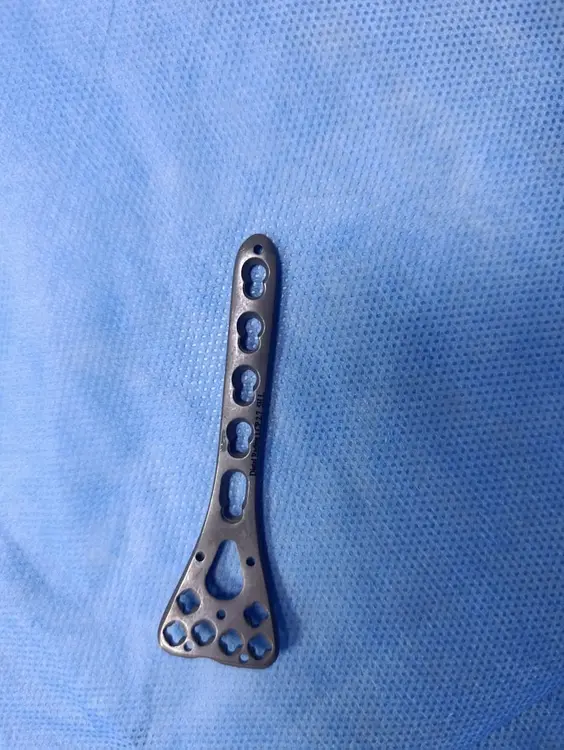 Distal Radius Plates Titanium