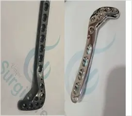 Locking Proximal Tibia Plate 4.5mm