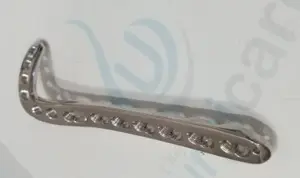 Y plate locking